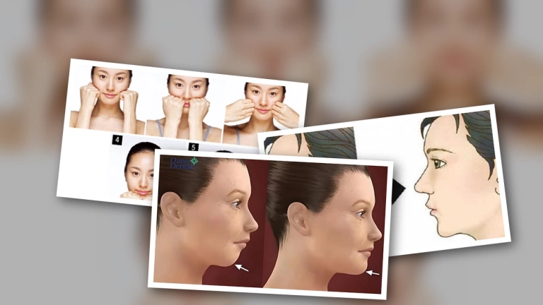 Bài tập khắc phục cằm lẹm hiệu quả ngay tại nhà