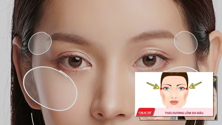 Bí quyết massage làm đầy thái dương tự nhiên và hiệu quả tại nhà