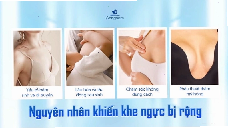 Cấu trúc xương lồng ngực ảnh hưởng đến khoảng cách khe ngực