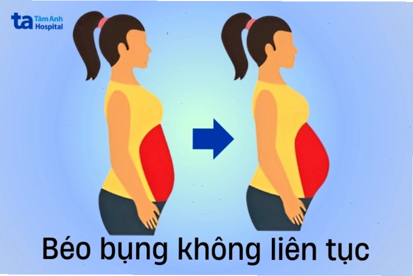 Hình ảnh bụng mỡ nữ có kích thước thay đổi theo thời gian
