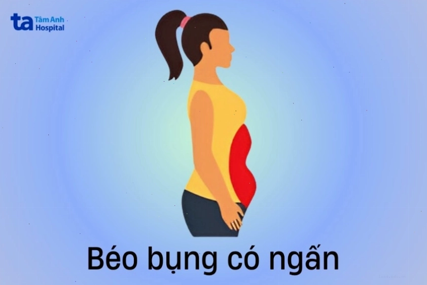 Hình ảnh minh họa kiểu bụng béo có ngấn ở nữ
