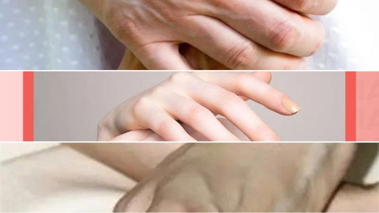 Làm Sao Để Có Gân Tay Nữ: Hướng Dẫn Chi Tiết Từ A-Z