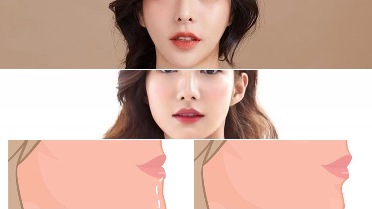 Mặt V line là gì? Tiêu chuẩn và bí quyết sở hữu khuôn mặt V line đẹp