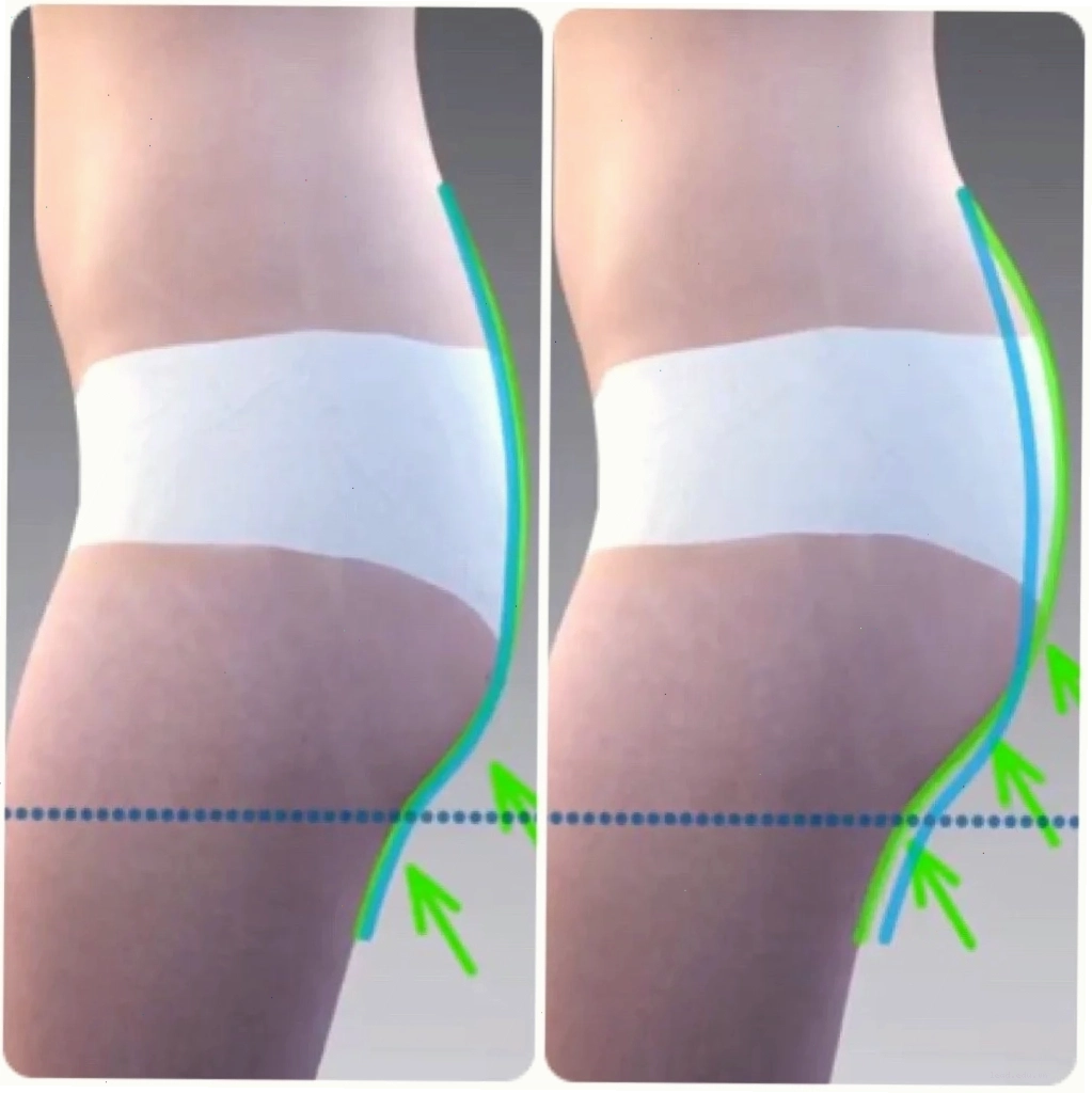 Máy Emsculpt trong không gian spa