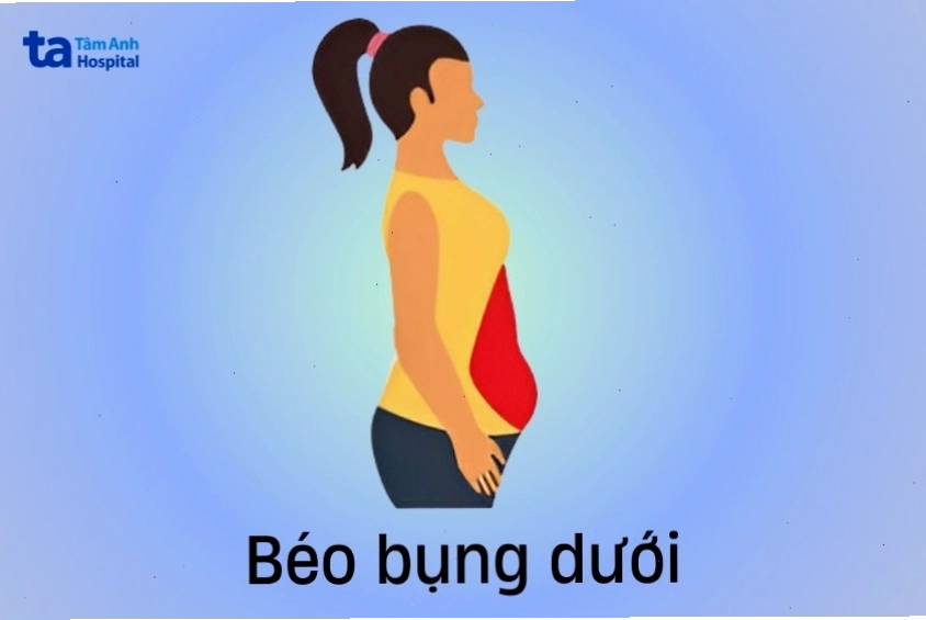 Minh họa kiểu bụng béo dưới ở nữ giới