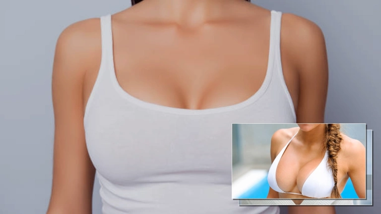 Rãnh Ngực: Nguyên Nhân, Cách Khắc Phục và Bí Quyết Tạo Khe Ngực Đẹp