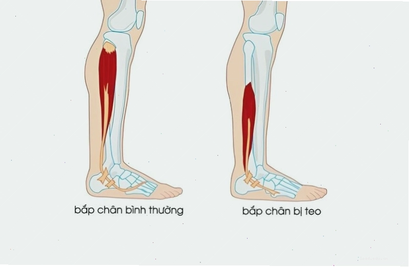 Trẻ em đang thực hiện động tác bật nhảy tại chỗ với biểu cảm vui vẻ